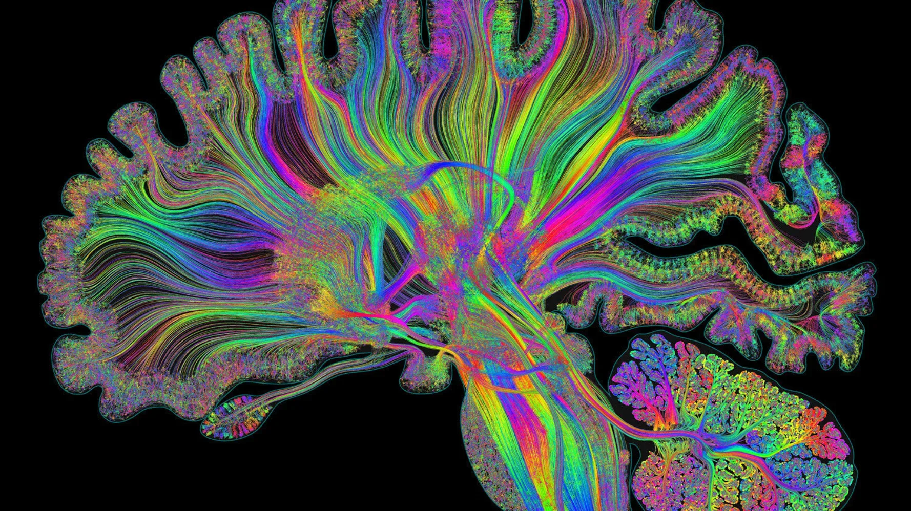 拡散トラクトグラフィで描いた脳の白質線維束。線維の向きに応じて虹色に色分けされ、背景は黒